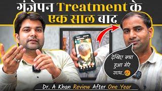 "एक साल पहले Hair Locking कराया था और आज.." | Dr A Khan | Review After 1 Year