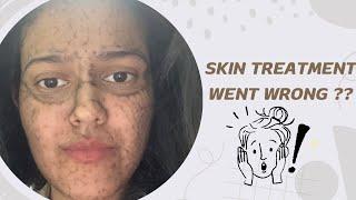 Skin treatment went wrong?#skincare #skincaretips #skincareroutine #tanning #acnetreatment #acnescar