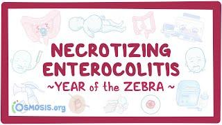 Necrotizing enterocolitis (Year of the Zebra 2024)