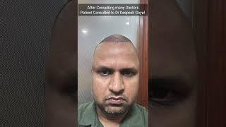 Hair Transplant Results in Jaipur | Best Hair Transplant Clinic | Rejuvena Cosmo Care