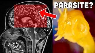 Tapeworm INFESTED Grandma’s Brain, Here's What Happened Next...