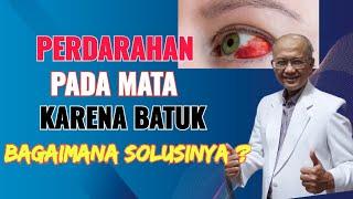 Perdarahan Pada Mata Karena Batuk  Bagaimana Solusinya? | dr. Basuki Rokhmad