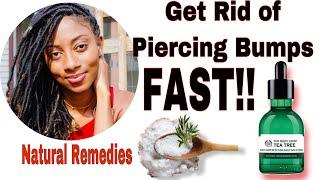 How to- 3 Ways to heal piercings FAST/Immediate Results @funtasfit​