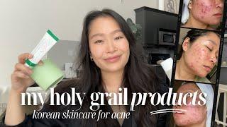 my updated HOLY GRAIL skincare products | how I heal active breakouts, adult acne, and scarring