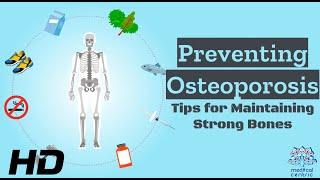 Osteoporosis Prevention 101: Your Guide to Maintaining Strong Bones