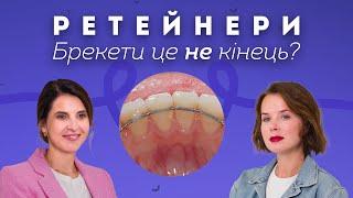 Ретейнери. Все про період закріплення результатів після брекетів | Stoma Talk