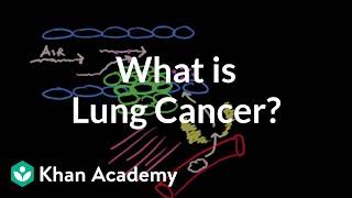 What is lung cancer? | Respiratory system diseases | NCLEX-RN | Khan Academy