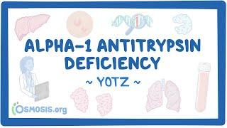 Alpha-1 antitrypsin deficiency (Year of the Zebra 2024)