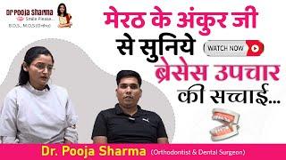 Braces Journey of Patient From Meerut & Common Myths Resolved About Braces Treatment - Dr Pooja