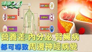 營養差.內分泌.腎臟病 都可導致周邊神經病變 健康2.0