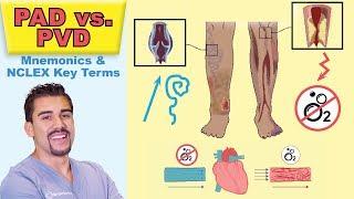 Peripheral Arterial Disease   Top Tested Signs & Symptoms for Peripheral Vascular PAD vs  PVD   Memo