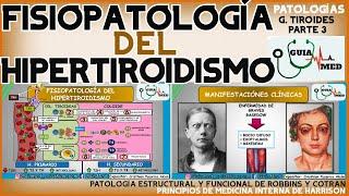 HIPERTIROIDISMO FISIOPATOLOGÍA | GuiaMed