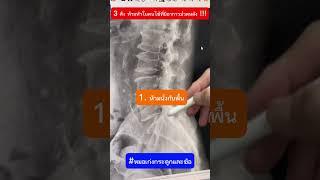 3 สิ่งห้ามทำในคนไข้ที่มีอาการปวดหลัง #ปวดหลัง #ปวด  #ปวดเอว #หมอเก่งกระดูกและข้อ #ปวดสะโพก