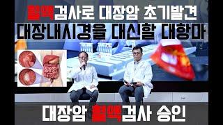 대장내시경을 대신할 혈액검사로 대장암 조기발견 #대장내시경 , #대장암 #피검사 대장내시경 꼭 해야하나?