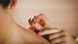 Expert with 10 Years Experience Shares Top Acupuncture Tips