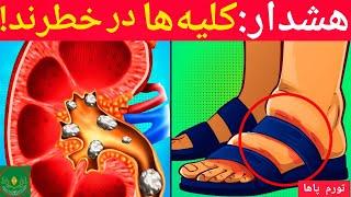 اگر میخوای کلیه های سالمی داشته باشی به این نشانه ها دقت کن/علائم کلیه ی ناسالم#کلیه #سلامتي #درمان