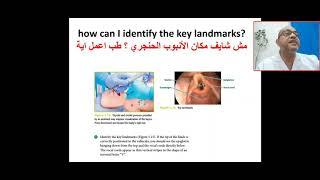 How can I identify key landmark for intubation? vocal cord, blade inserted not enough or so far