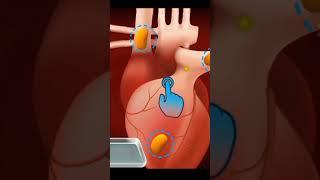  Hot Surgery  Hospital #surgerysimplified #surgery #shortvideo #shorts #doctor