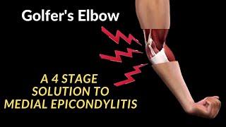 Golfer’s Elbow - 4 stage solution for MEDIAL EPICONDYLITIS!