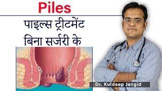 Piles (मस्से/बवासीर)  Permanent Solution | Piles Permanent treatment | Best Treatment of Piles