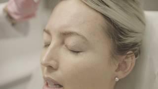 Botox for Fine Lines and Wrinkles | Skin Institute by Dr. Marina K. | Toronto ON