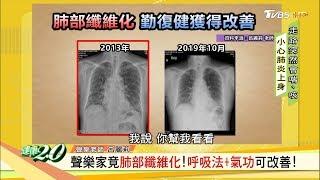 病毒攻肺導致纖維化！病患咳不停、動就喘！復健能改善？健康2.0