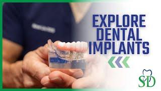 Dental Implants Are A Game Changer | Explore Dental Implants