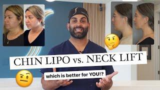 Chin Lipo Vs. Deep Neck Lift.. which is better for YOU!?