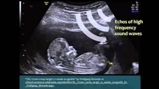 Introduction to Ultrasound Technology in Linguistics