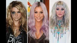 CALLING ALL PUNKS!!! EMBRACE YOUR INNER KESHA!!! BE FREE!!! BE TRULY FREE!!!