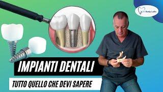 Impianti Dentali: Tutto quello che Devi Sapere.