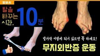 무지외반증에 꼭 필요한 운동 프로그램