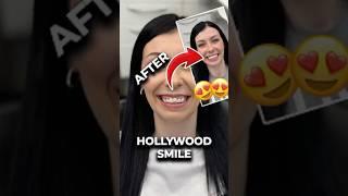 This Smile Upgrade Will Change Your Life! 