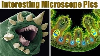 The Most Interesting Pictures of Things Under Microscope