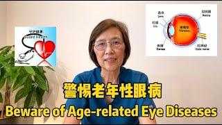 警惕老年性眼病 Beware of Age-related Eye Diseases 中老年医疗保健系列短视频 (37)