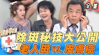 斑愈多=皮膚癌？這兩處出現不明黑痣 恐是致命癌症 都市傳說：抹香蕉皮可以除斑？專家教你有效根除老人斑點！｜健康零距離 EP255 完整版