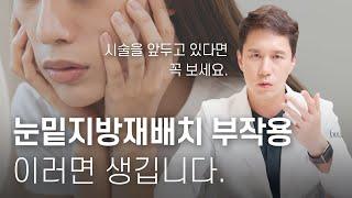 눈밑지방재배치 부작용의 모든 것