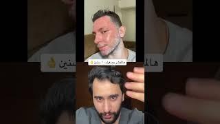 هالمقشر معجزة رح يصغرك ١٠ سنين  | دكتور يوسف