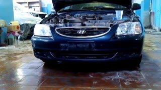 Hyundai Accent. Снятие переднего бампера и фары.