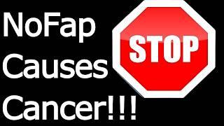 NoFap Causes Prostate Cancer? - NEW Study Says You Should Bust 20x/Month