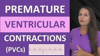 Premature Ventricular Contractions (PVCs) ECG Nursing NCLEX Bigeminy, Trigeminy