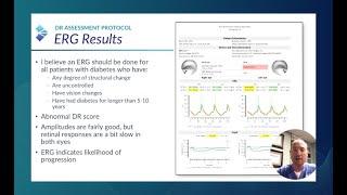 RETeval Optometric Case: ERG Alters Follow-up Schedule and Education (by Nate Lighthizer, OD)