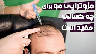 چرا مزوتراپی بهترین راه جلوگیری از ریزش مو است : مزوتراپی مو برای چه کسانی مفید است