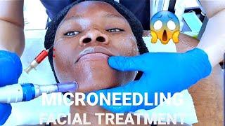 Getting my First Facial|MICRONEEDLING|Namibian YouTuber #Namibia #Microneedling