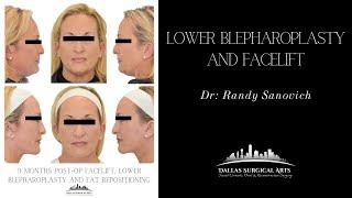 A Look Inside the OR: Lower Blepharoplasty and Facelift by Dr. Randy Sanovich