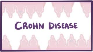 Crohn's disease (Crohn disease) - causes, symptoms & pathology