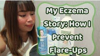 How I Control My Eczema From Flaring Up