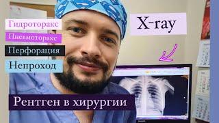 X-ray in surgery/ Рентгенография в хирургии. Научим видеть рентген-картину в двух словах.