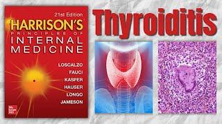 THYROIDITIS | Classification | Causes | Clinical Features | Treatment | Harrision