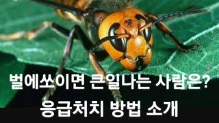 벌에 쏘이면 큰일나는 체질? 상비약은?